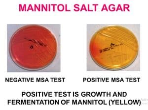 Mannitol Salt Agar Plate