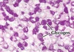 periodic-acid-schiff-pas-stain