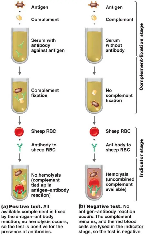 Complement Fixation Test principle, procedure and interpretation