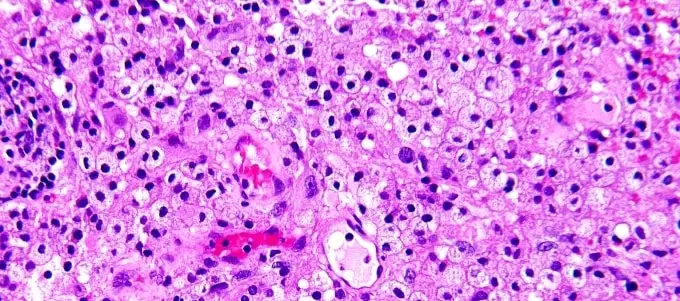 Hematoxylin And Eosin Staining Principle Procedure And Interpretation Laboratoryinfo Com