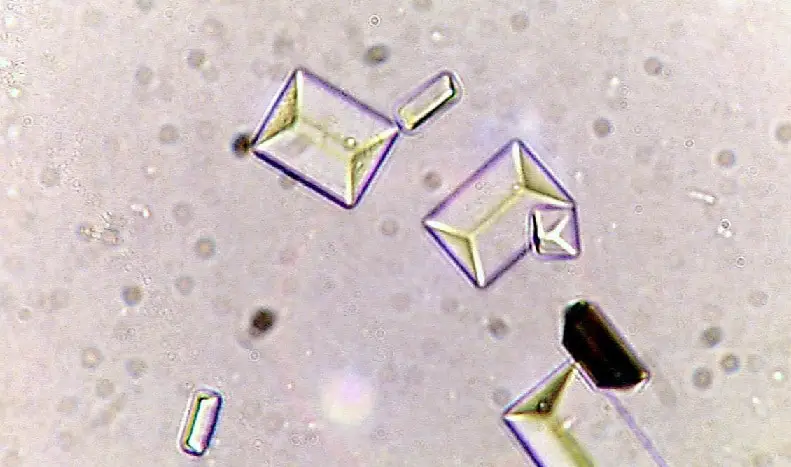 Triple-phosphate-crystal