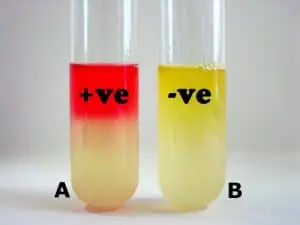 Methyl Red Test : principle, procedure and interpretation