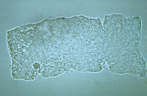 Hyaline Casts In Urine Microscopic Analysis Of Urine Faculty Of Medicine The Presence 6617