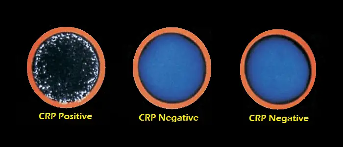 Crp Test Range Chart