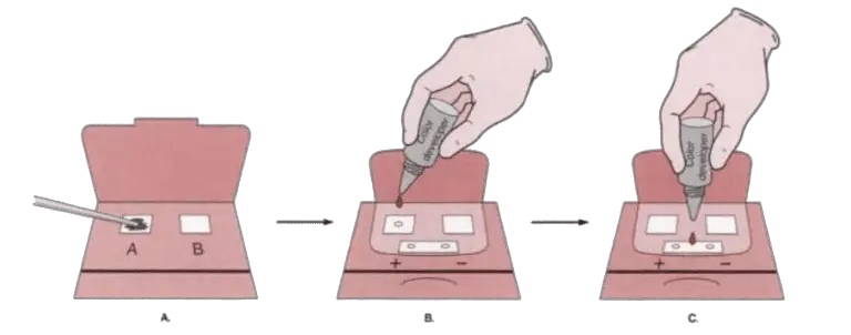 fecal-occult-blood-test-methods-principle-procedure-clinical