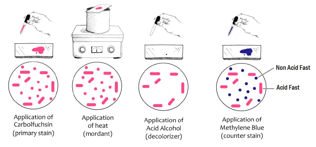 Gram Stain Interpretation Chart