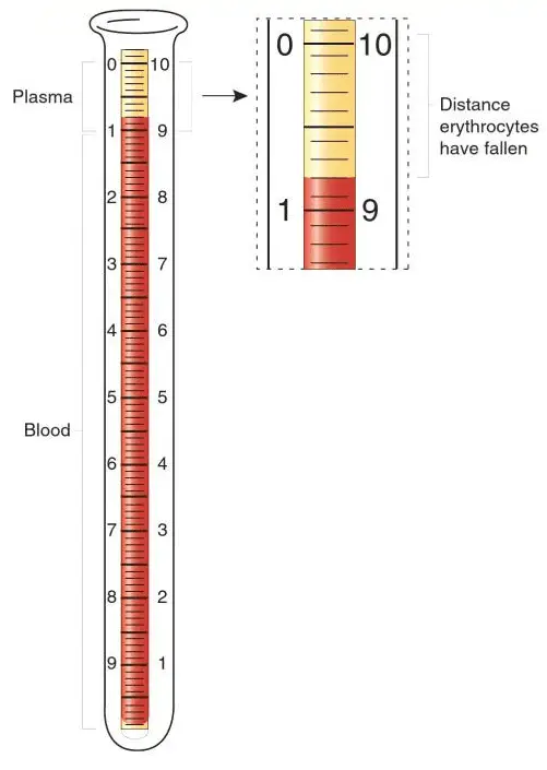 Sed Rate Levels Chart