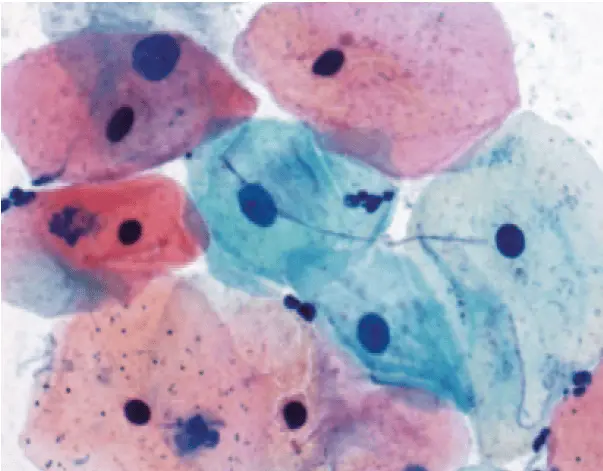 material are used how (PAP) Staining Introduction, : Principle Papanicolaou