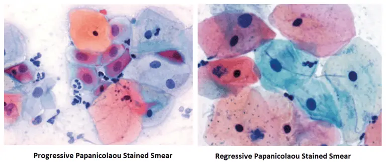 Papanicolaou (PAP) Staining : Introduction, Principle, Procedure And ...