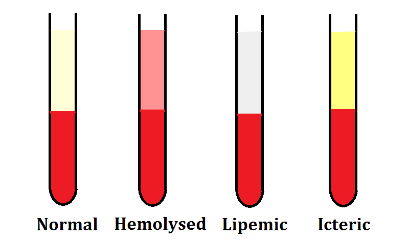 Hemolysis Index Chart