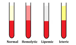 Tests Affected by Hemolyzed, Lipemic and Icteric Samples And Their Mechanism
