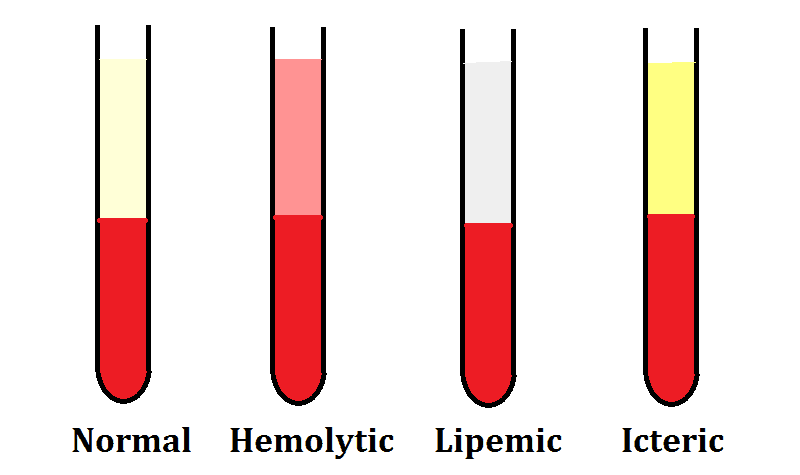Липемия образца крови что это