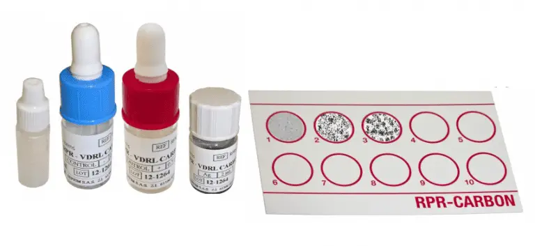 Rapid Plasma Reagin (RPR) Test : Principle, Procedure, Interpretation ...