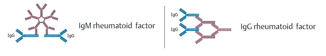 Ra Factor Level Chart