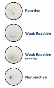 Venereal Disease Research Laboratory (VDRL) Test : Principle, Procedure