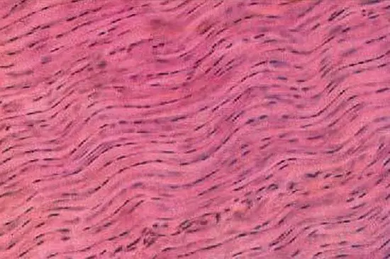 A closer look at dense regular connective tissues