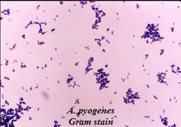 Coccobacilli Gram Negative Bacteria LaboratoryInfocom 