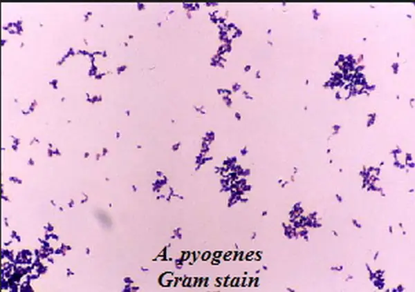 gram negative rods vs bacilli