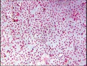 Gram-negative Bacteria: Characteristics, List, Cell wall composition, Classification, and Antibiotics