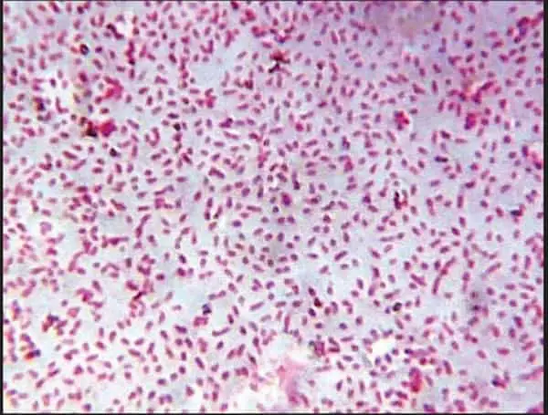 Gram staining of the culture gram negative coccobacilli image