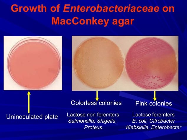 macconkey-agar-plate-purpose-ingredients-and-principle