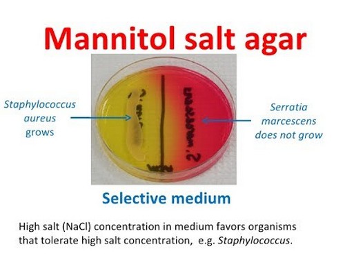 mannitol-salt-agar-plate-test-composition-preparation-uses