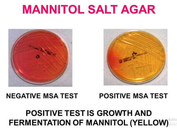 microbiology-lab-report-on-escherichia-coli-and-staphylococcus-aureus