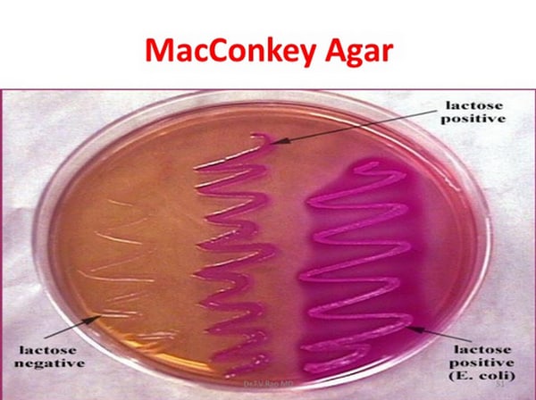 lactose positive gram negative rods