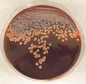 EMB (Eosin Methylene Blue) Agar – Plate, Composition and Results