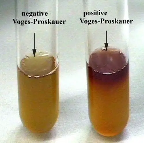 Two test tubes; the other one test negative for VP test and the other one is positive