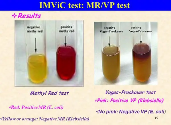 comparison image between methyl red test and Voges Proskauer test