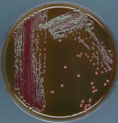 emb agar with formed colonies of microorganisms.