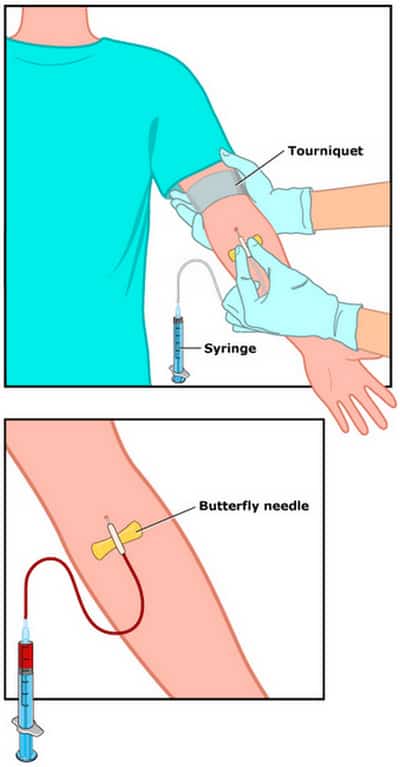 What Is CMP Blood Test And Results Explained Laboratoryinfo