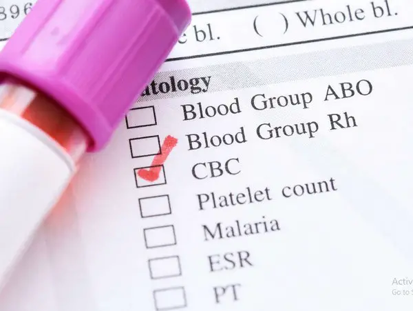 Low Platelet Count Range Chart