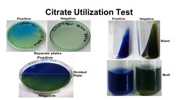 result of citrate utilization test