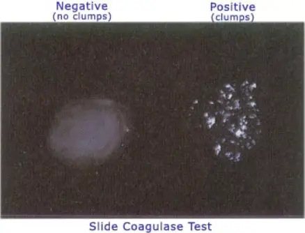 slide coagulase test