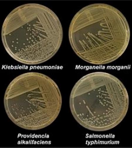 Four types of bacteria are being tested for growth in nutrient agar