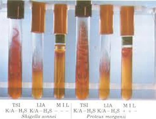 what-is-gastrointestinal-motility-test