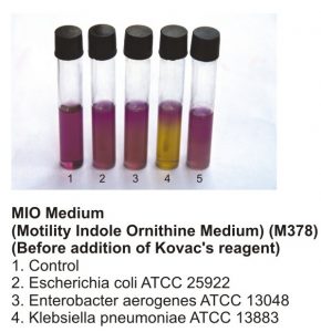 Motility test using the MIO medium