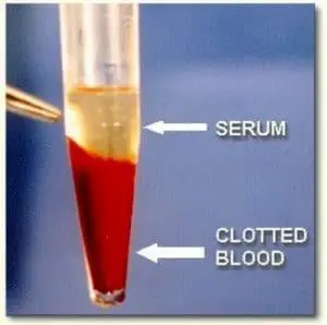Difference between Serum and Plasma