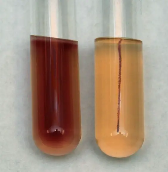 The test tube on the left is positive for motility test while the test tube on the right tests negative