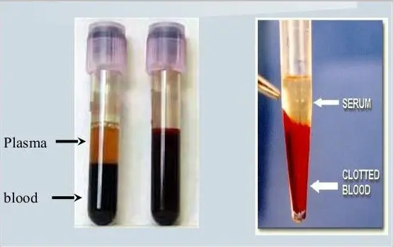 Two test tubes with plasma and serum blood components