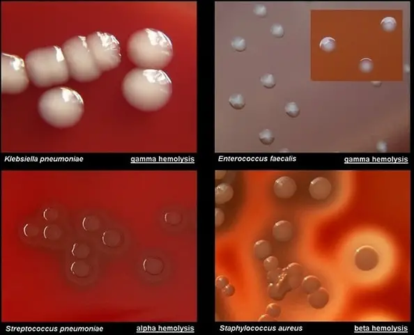 blood agar showing different kinds of hemolysis and the bacteria