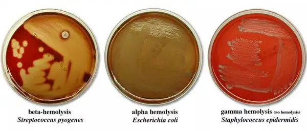 petri plates with different types of hemolysis