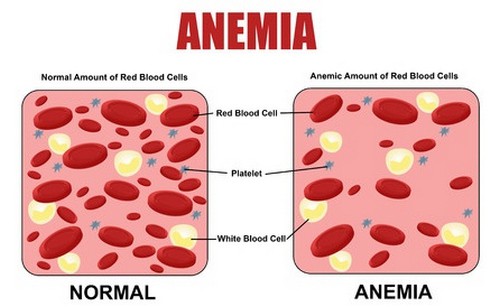 What Is Mch Blood Test And What Does It Mean Laboratoryinfo Com