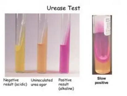 Four test tubes of urease test with varying degree of results