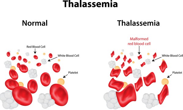 What Is Mch Blood Test And What Does It Mean Laboratoryinfo Com