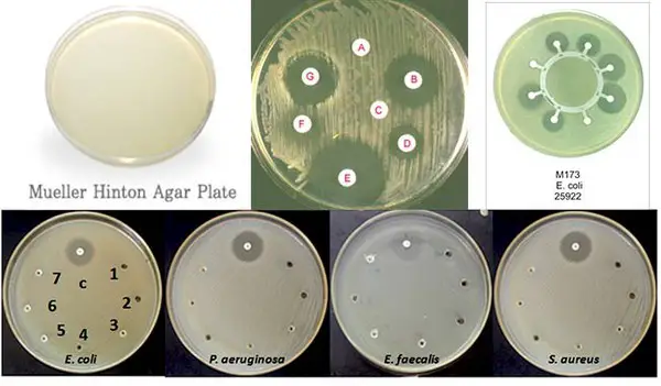 Various organisms tested in a Mueller Hinton agar plate