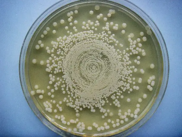 Visible growth colonies in a Mueller Hinton agar