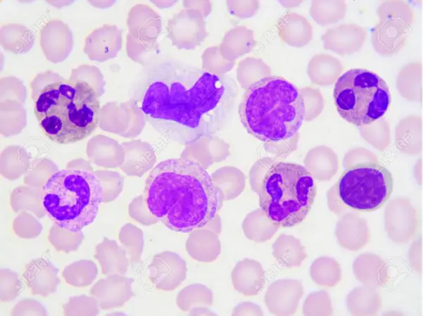 White blood cells in a blood smear